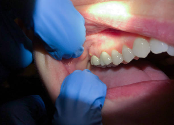 Best Weekend Emergency Dentist in Newaygo, MI
